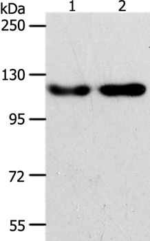 ABL2 Antibody