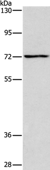 ACADVL Antibody