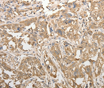 ADHFE1 Antibody