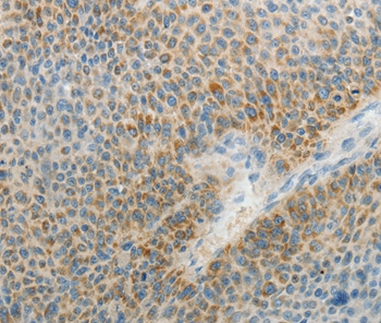 AGAP1 Antibody