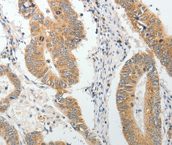 AKAP1 Antibody