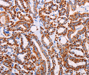 AGTR2 Antibody