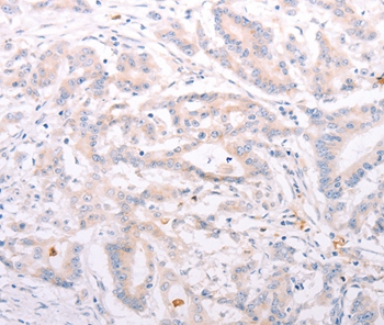 ANKRA2 Antibody