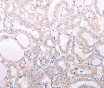 ANKRA2 Antibody