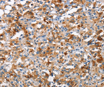 TSC2 Antibody