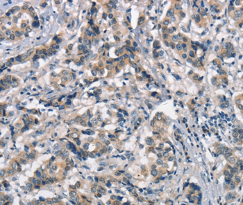 APOA1BP Antibody - SAB | Signalway Antibody