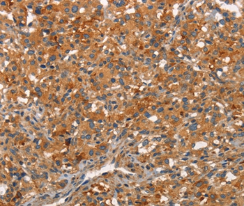 ARPC2 Antibody