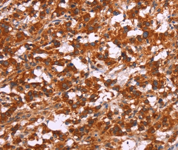 ARPC4 Antibody