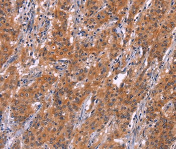 ARPC4 Antibody