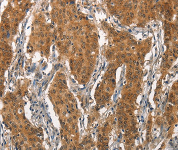 ITGA2 Antibody