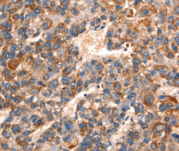 GJA8 Antibody