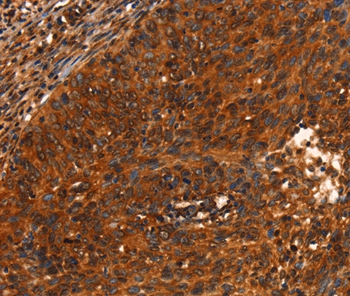 PRKD1 Antibody