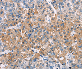 LATS2 Antibody