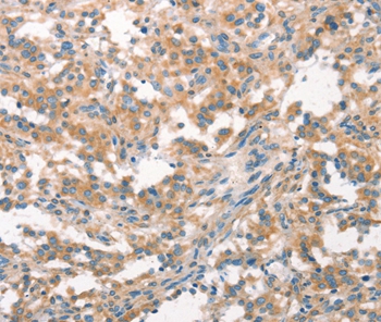 WNK3 Antibody