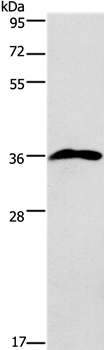 PRPS1/2/1L1 Antibody