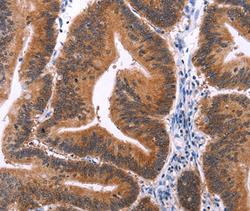 MAPK13 Antibody