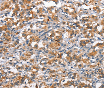 ANP32C Antibody