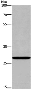 ANP32C Antibody