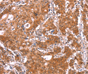 BCAR1 Antibody