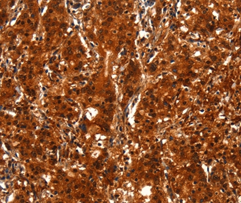 BCAS3 Antibody