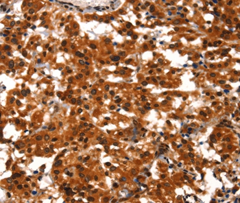 BCAS3 Antibody