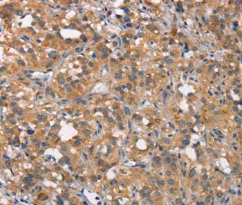 CEACAM6 Antibody