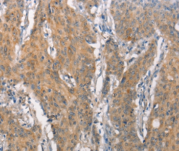 CEACAM6 Antibody