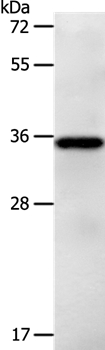 LPPR5 Antibody