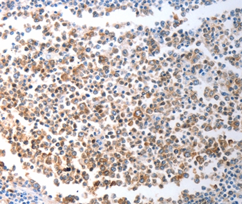 CHD5 Antibody