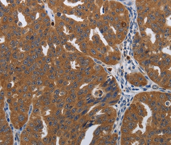 PDCD2 Antibody