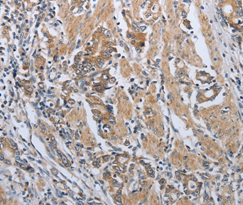 PDCD1 Antibody