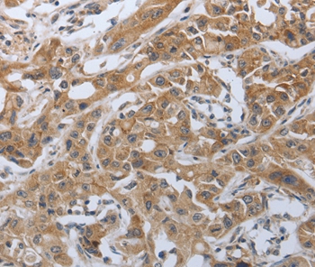 PDCD1 Antibody