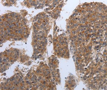 PDIA2 Antibody