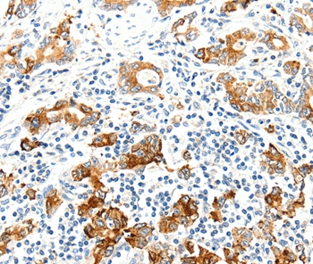 SEL1L Antibody