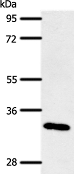 SLC2A4RG Antibody