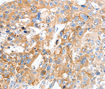 SLC22A17 Antibody