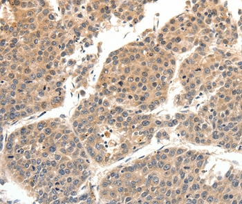 SLC27A1 Antibody