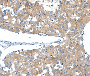 SSTR3 Antibody