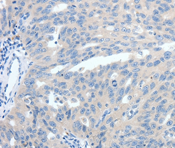 SSTR3 Antibody