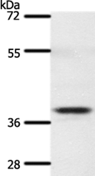 SSTR5 Antibody