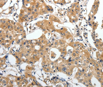 STEAP4 Antibody