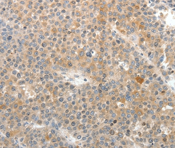 SV2A Antibody