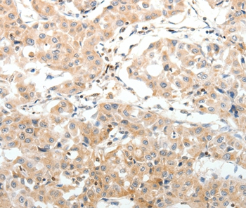 SV2A Antibody