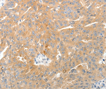 TEP1 Antibody