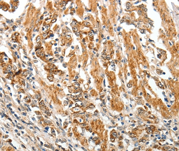 TGFBR1 Antibody