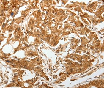 TGFBR1 Antibody