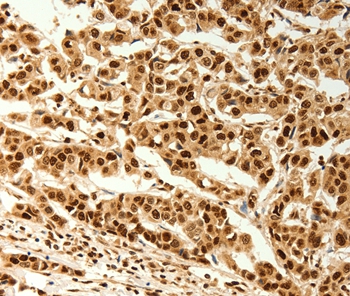 C12orf5 Antibody