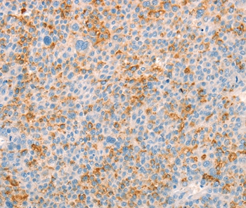 TRPM7 Antibody