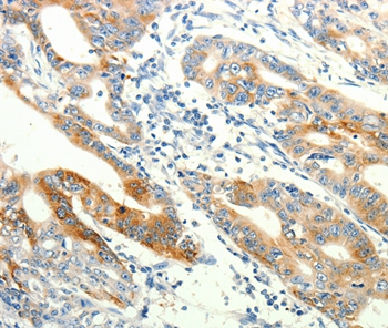 TRPA1 Antibody