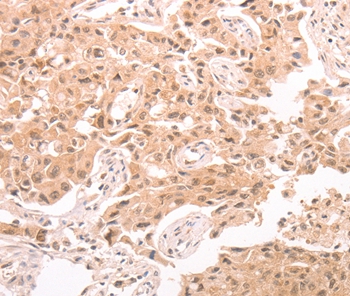 TRPC3 Antibody